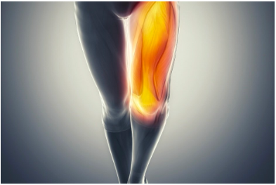 What are the Quadriceps?